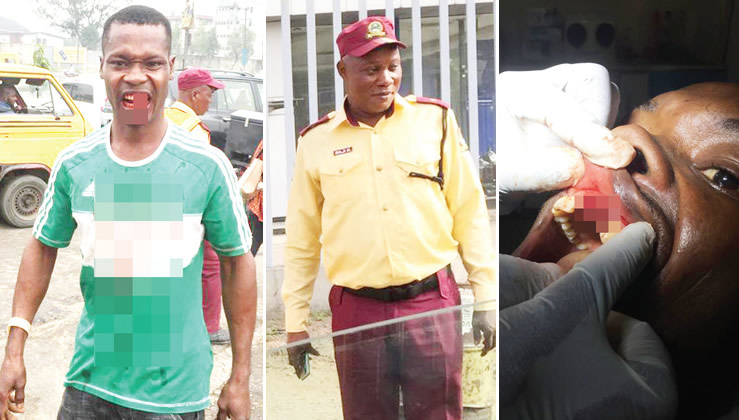 Driver loses two teeth to LASTMA, police brutality in Ikeja